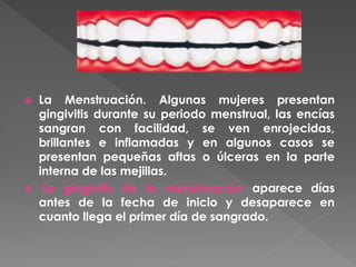  La Menstruación. Algunas mujeres presentan
gingivitis durante su periodo menstrual, las encías
sangran con facilidad, se ven enrojecidas,
brillantes e inflamadas y en algunos casos se
presentan pequeñas aftas o úlceras en la parte
interna de las mejillas.
 La gingivitis de la menstruación aparece días
antes de la fecha de inicio y desaparece en
cuanto llega el primer día de sangrado.
 