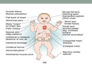 Common Genetic Disorders