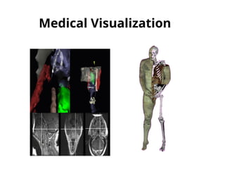 Medical Visualization
 