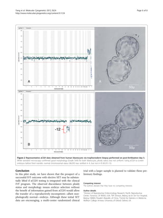 Yang et al. Molecular Cytogenetics 2012, 5:24 Page 6 of 8 
http://www.molecularcytogenetics.org/content/5/1/24 
Conclusion 
In this pilot study, we have shown that the prospect of a 
successful IVF outcome with elective SET may be substan-tially 
lifted if aCGH testing is integrated with the clinical 
IVF program. The observed discordance between ploidy 
status and morphology means embryo selection without 
the benefit of information gained from aCGH would allow 
the transfer of a reproductively incompetent—albeit mor-phologically 
normal—embryo. Although these initial SET 
data are encouraging, a multi-center randomized clinical 
trial with a larger sample is planned to validate these pre-liminary 
findings. 
Competing interest 
The authors declare that they have no competing interests. 
Author details 
1Division of Reproductive Endocrinology Research, Pacific Reproductive 
Center, Torrance, CA 90505, USA. 2IVF Division, Beijing Jia En De Yun Hospital, 
Beijing 100083, People's Republic of China. 3Centre for Statistics in Medicine, 
Wolfson College Annexe, University of Oxford, Oxford, UK. 
A 
B 
-12 
A 
B 
50μ 
50μ 
Figure 2 Representative aCGH data obtained from human blastocysts via trophectoderm biopsy performed on post-fertilization day 5. 
While standard microscopy confirmed good morphology (Grade 5AA) for both blastocysts, ploidy status was not uniform. Using aCGH to screen 
embryos before fresh transfer, normal chromosomal status (46,XX) was verified in A, but not in B (45,XY,-12). 
 