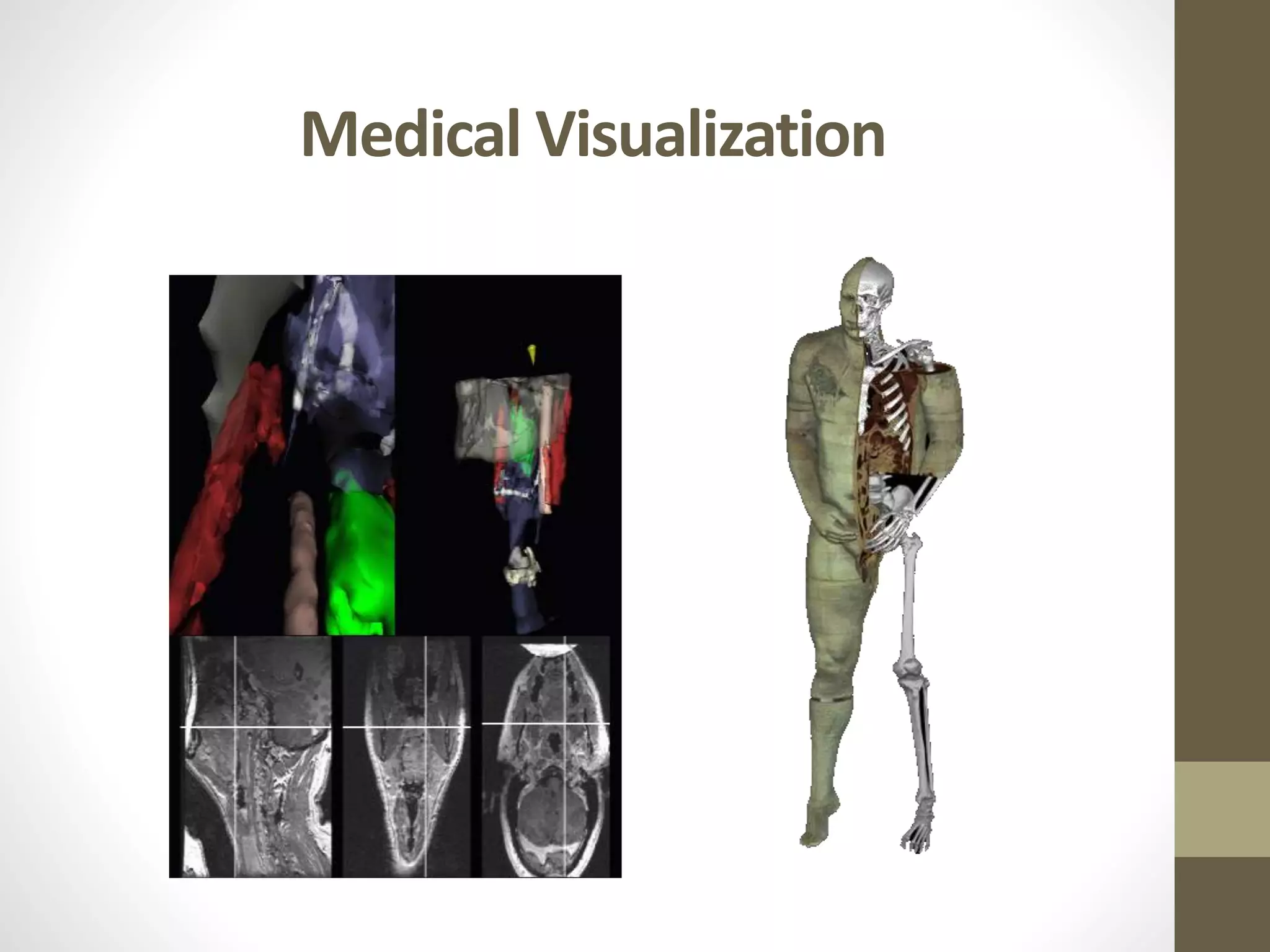 Medical Visualization
 