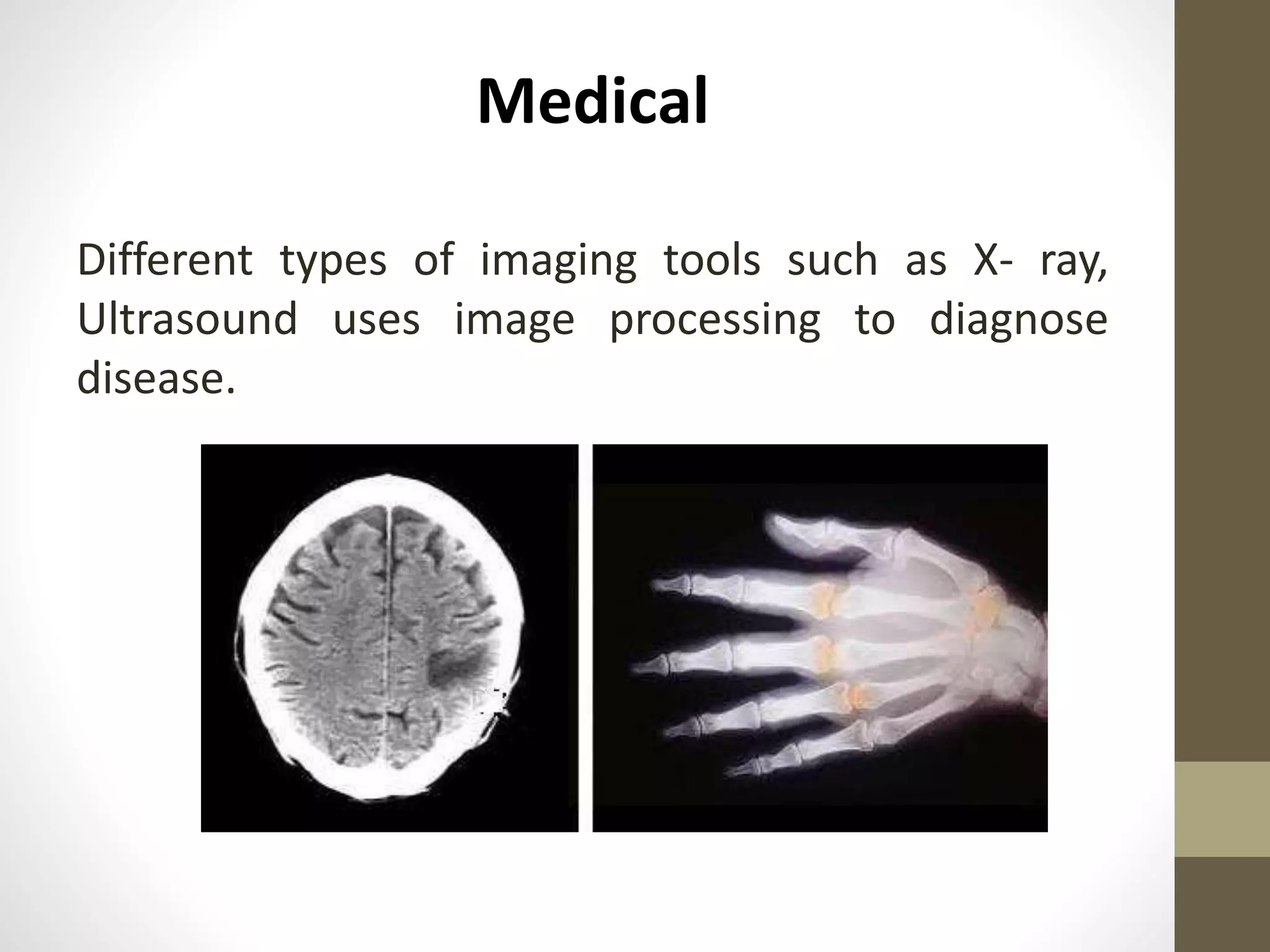 Medical
Different types of imaging tools such as X- ray,
Ultrasound uses image processing to diagnose
disease.
 