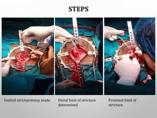 STEPS
Ventral stricturotomy made Distal limit of stricture
determined
Proximal limit of
stricture
 