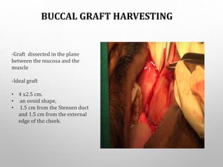 BUCCAL GRAFT HARVESTING
-Graft dissected in the plane
between the mucosa and the
muscle
-Ideal graft
• 4 x2.5 cm.
• an ovoid shape,
• 1.5 cm from the Stensen duct
and 1.5 cm from the external
edge of the cheek.
 