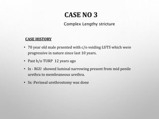CASE NO 3
CASE HISTORY
• 70 year old male prsented with c/o voiding LUTS which were
progressive in nature since last 10 years.
• Past h/o TURP 12 years ago
• Ix - RGU showed luminal narrowing present from mid penile
urethra to membraneous urethra.
• Sx :Perineal urethrostomy was done
Complex Lengthy stricture
 
