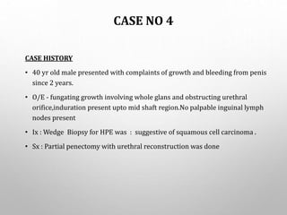 CASE NO 4
CASE HISTORY
• 40 yr old male presented with complaints of growth and bleeding from penis
since 2 years.
• O/E - fungating growth involving whole glans and obstructing urethral
orifice,induration present upto mid shaft region.No palpable inguinal lymph
nodes present
• Ix : Wedge Biopsy for HPE was : suggestive of squamous cell carcinoma .
• Sx : Partial penectomy with urethral reconstruction was done
 