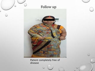 Patient completely free of
disease
Follow up
 
