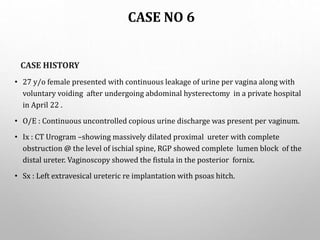 CASE NO 6
CASE HISTORY
• 27 y/o female presented with continuous leakage of urine per vagina along with
voluntary voiding after undergoing abdominal hysterectomy in a private hospital
in April 22 .
• O/E : Continuous uncontrolled copious urine discharge was present per vaginum.
• Ix : CT Urogram –showing massively dilated proximal ureter with complete
obstruction @ the level of ischial spine, RGP showed complete lumen block of the
distal ureter. Vaginoscopy showed the fistula in the posterior fornix.
• Sx : Left extravesical ureteric re implantation with psoas hitch.
 