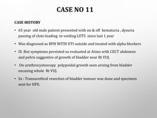 CASE NO 11
CASE HISTORY
• 65 year old male patient presented with on & off hematuria , dysuria
passing of clots-leading to voiding LUTS since last 1 year
• Was diagnosed as BPH WITH UTI outside and treated with alpha blockers
• IX :But symptoms persisted so evaluated at Aiims with CECT abdomen
and pelvis suggestive of growth of bladder near Rt VUJ.
• On urethrocystoscopy polypoidal growth seen arising from bladder
encasing whole Rt VUJ.
• Sx : Transurethral resection of bladder tumour was done and specimen
sent for HPE.
 