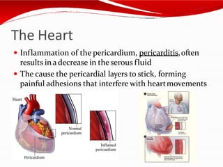 The Heart
 Inflammation of the pericardium, pericarditis,often
results in a decrease in the serous fluid
 The cause the pericardial layers to stick, forming
painful adhesions that interfere with heartmovements
 