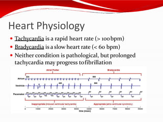 Heart Physiology
 Tachycardia is a rapid heart rate (> 100bpm)
 Bradycardia is a slow heart rate (< 60 bpm)
 Neither condition is pathological, butprolonged
tachycardia may progress tofibrillation
 