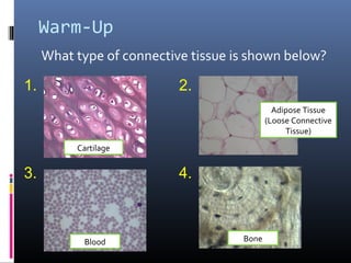 Warm-Up
What type of connective tissue is shown below?
1. 2.
3. 4.
Cartilage
Blood
Adipose Tissue
(Loose Connective
Tissue)
Bone
 