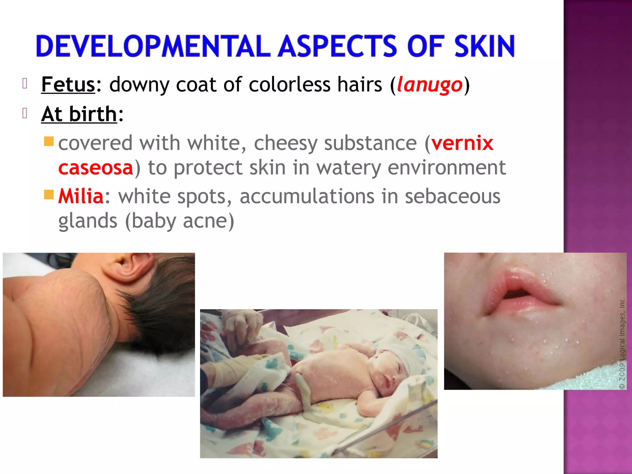  Fetus: downy coat of colorless hairs (lanugo)
 At birth:
covered with white, cheesy substance (vernix
caseosa) to protect skin in watery environment
Milia: white spots, accumulations in sebaceous
glands (baby acne)
 