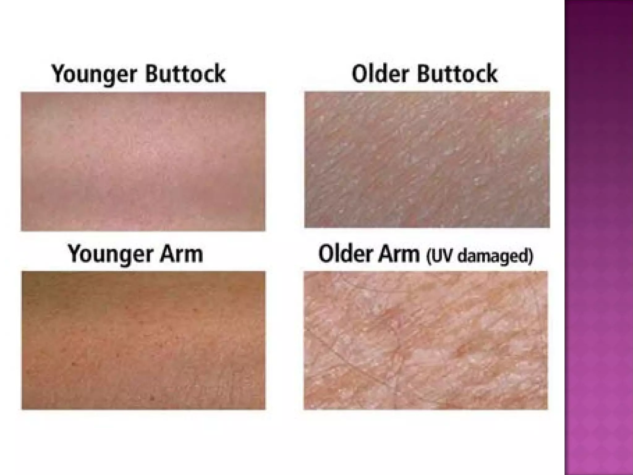 Ch. 5 integumentary system - part 3