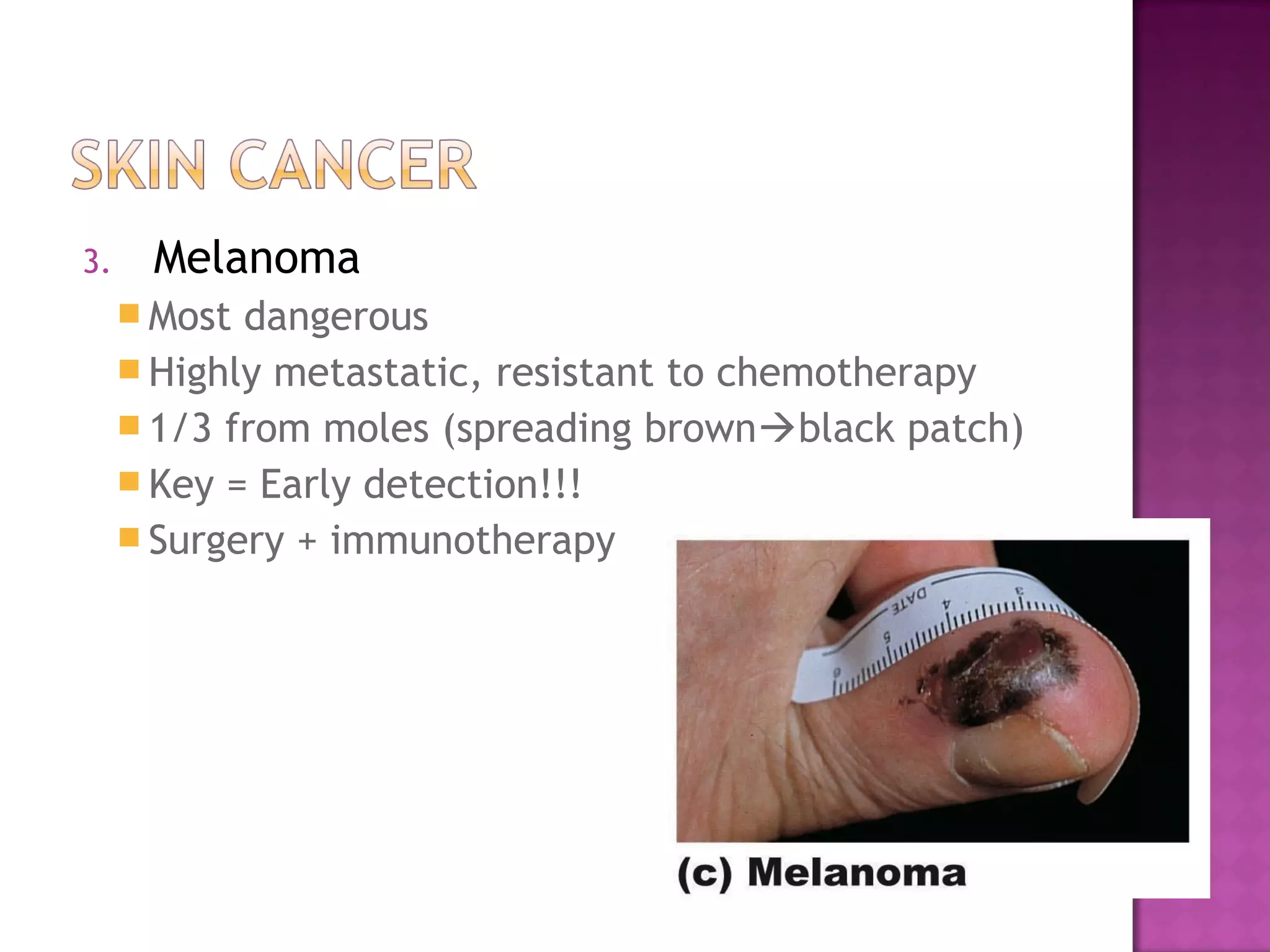 3. Melanoma
 Most dangerous
 Highly metastatic, resistant to chemotherapy
 1/3 from moles (spreading brownblack patch)
 Key = Early detection!!!
 Surgery + immunotherapy
 