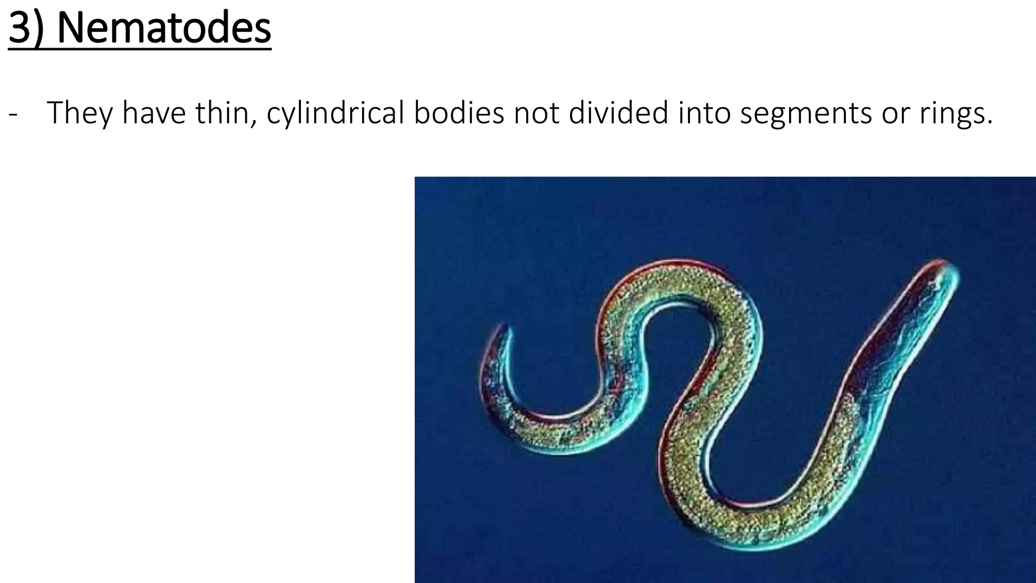3) Nematodes
- They have thin, cylindrical bodies not divided into segments or rings.
 