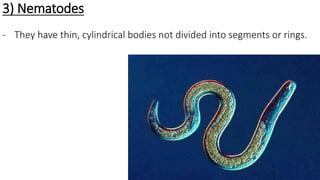 3) Nematodes
- They have thin, cylindrical bodies not divided into segments or rings.
 