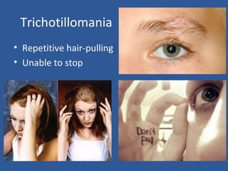 Trichotillomania
• Repetitive hair-pulling
• Unable to stop
 