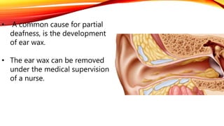 • A common cause for partial
deafness, is the development
of ear wax.
• The ear wax can be removed
under the medical supervision
of a nurse.
 