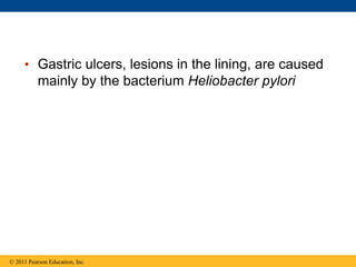 • Gastric ulcers, lesions in the lining, are caused
mainly by the bacterium Heliobacter pylori
© 2011 Pearson Education, Inc.
 