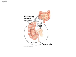 Figure 41.15
Ascending
portion
of colon
Small
intestine
Appendix
Cecum
 