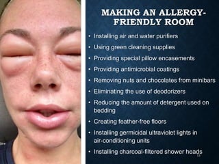 © 2008, Educational Institute
MAKING AN ALLERGY-
FRIENDLY ROOM
• Installing air and water purifiers
• Using green cleaning supplies
• Providing special pillow encasements
• Providing antimicrobial coatings
• Removing nuts and chocolates from minibars
• Eliminating the use of deodorizers
• Reducing the amount of detergent used on
bedding
• Creating feather-free floors
• Installing germicidal ultraviolet lights in
air-conditioning units
• Installing charcoal-filtered shower heads
15
 