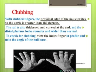 Nail Clubbing Algorithm Ch. 9- __Skin, hair and nail Assessment (1).pdf