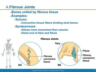 Copyright © 2009 Pearson Education, Inc., publishing as Benjamin Cummings *
A.Fibrous Joints
●Bones united by fibrous tissue
●Examples:
●Sutures:
●Connective tissue fibers binding skull bones
●Syndesmoses:
●Allows more movement than sutures
●Distal end of tibia and fibula
 