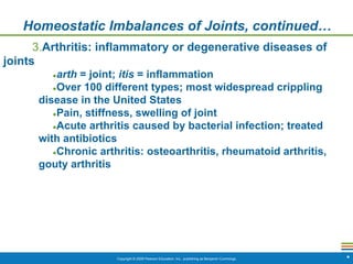 Copyright © 2009 Pearson Education, Inc., publishing as Benjamin Cummings *
Homeostatic Imbalances of Joints, continued…
3.Arthritis: inflammatory or degenerative diseases of
joints
●arth = joint; itis = inflammation
●Over 100 different types; most widespread crippling
disease in the United States
●Pain, stiffness, swelling of joint
●Acute arthritis caused by bacterial infection; treated
with antibiotics
●Chronic arthritis: osteoarthritis, rheumatoid arthritis,
gouty arthritis
 
