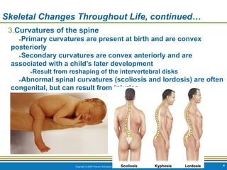 Copyright © 2009 Pearson Education, Inc., publishing as Benjamin Cummings *
Skeletal Changes Throughout Life, continued…
3.Curvatures of the spine
●Primary curvatures are present at birth and are convex
posteriorly
●Secondary curvatures are convex anteriorly and are
associated with a child’s later development
●Result from reshaping of the intervertebral disks
●Abnormal spinal curvatures (scoliosis and lordosis) are often
congenital, but can result from injuries
 