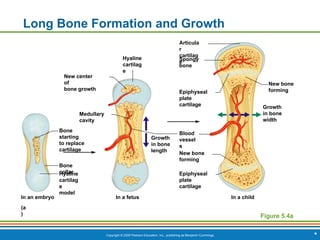 Copyright © 2009 Pearson Education, Inc., publishing as Benjamin Cummings *
Long Bone Formation and Growth
Figure 5.4a
Bone
starting
to replace
cartilage
Epiphyseal
plate
cartilage
Articula
r
cartilag
e
Spongy
bone
In a child
In a fetus
In an embryo
New bone
forming
Growth
in bone
width
Growth
in bone
length
Epiphyseal
plate
cartilage
New bone
forming
Blood
vessel
s
Hyaline
cartilag
e
New center
of
bone growth
Medullary
cavity
Bone
collar
Hyaline
cartilag
e
model
(a
)
 