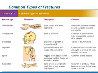 Copyright © 2009 Pearson Education, Inc., publishing as Benjamin Cummings *
Common Types of Fractures
Table 5.2
 