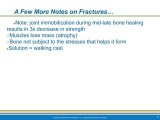 Copyright © 2009 Pearson Education, Inc., publishing as Benjamin Cummings
A Few More Notes on Fractures…
●Note: joint immobilization during mid-late bone healing
results in 3x decrease in strength
○Muscles lose mass (atrophy)
○Bone not subject to the stresses that helps it form
●Solution = walking cast
*
 