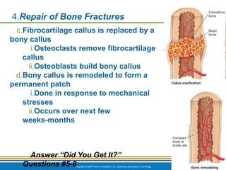Copyright © 2009 Pearson Education, Inc., publishing as Benjamin Cummings *
4.Repair of Bone Fractures
c.Fibrocartilage callus is replaced by a
bony callus
i.Osteoclasts remove fibrocartilage
callus
ii.Osteoblasts build bony callus
d.Bony callus is remodeled to form a
permanent patch
i.Done in response to mechanical
stresses
ii.Occurs over next few
weeks-months
Answer “Did You Get It?”
Questions #5-8
 