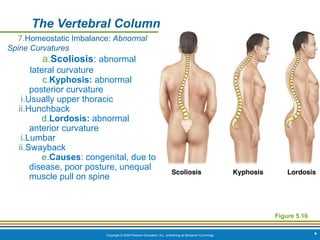 Copyright © 2009 Pearson Education, Inc., publishing as Benjamin Cummings *
The Vertebral Column
Figure 5.16
7.Homeostatic Imbalance: Abnormal
Spine Curvatures
a.Scoliosis: abnormal
lateral curvature
c.Kyphosis: abnormal
posterior curvature
i.Usually upper thoracic
ii.Hunchback
d.Lordosis: abnormal
anterior curvature
i.Lumbar
ii.Swayback
e.Causes: congenital, due to
disease, poor posture, unequal
muscle pull on spine
 