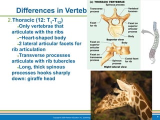 Copyright © 2009 Pearson Education, Inc., publishing as Benjamin Cummings
Differences in Vertebrae
2.Thoracic (12: T1
-T12
)
●Only vertebrae that
articulate with the ribs
●~Heart-shaped body
●2 lateral articular facets for
rib articulation
●Transverse processes
articulate with rib tubercles
●Long, thick spinous
processes hooks sharply
down: giraffe head
*
 