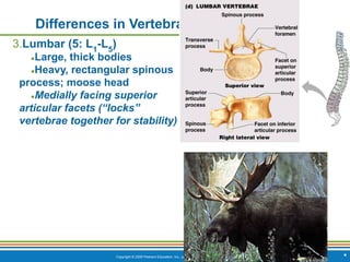 Copyright © 2009 Pearson Education, Inc., publishing as Benjamin Cummings
Differences in Vertebrae
3.Lumbar (5: L1
-L5
)
●Large, thick bodies
●Heavy, rectangular spinous
process; moose head
●Medially facing superior
articular facets (“locks”
vertebrae together for stability)
*
 