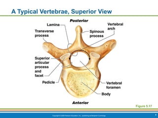 Copyright © 2009 Pearson Education, Inc., publishing as Benjamin Cummings *
A Typical Vertebrae, Superior View
Figure 5.17
 