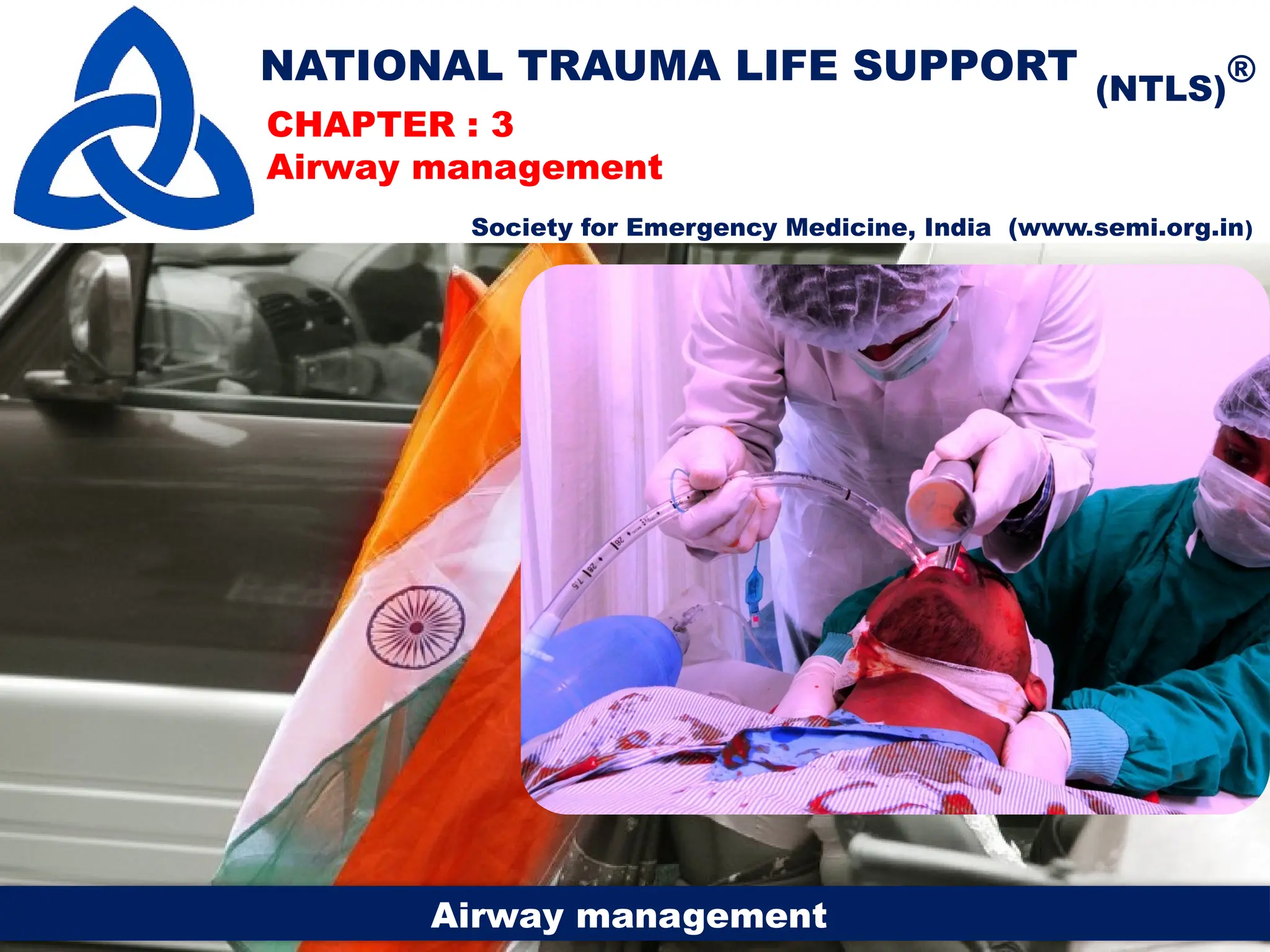 Ch.3 Airway Management.pptx trauma important | PPTX