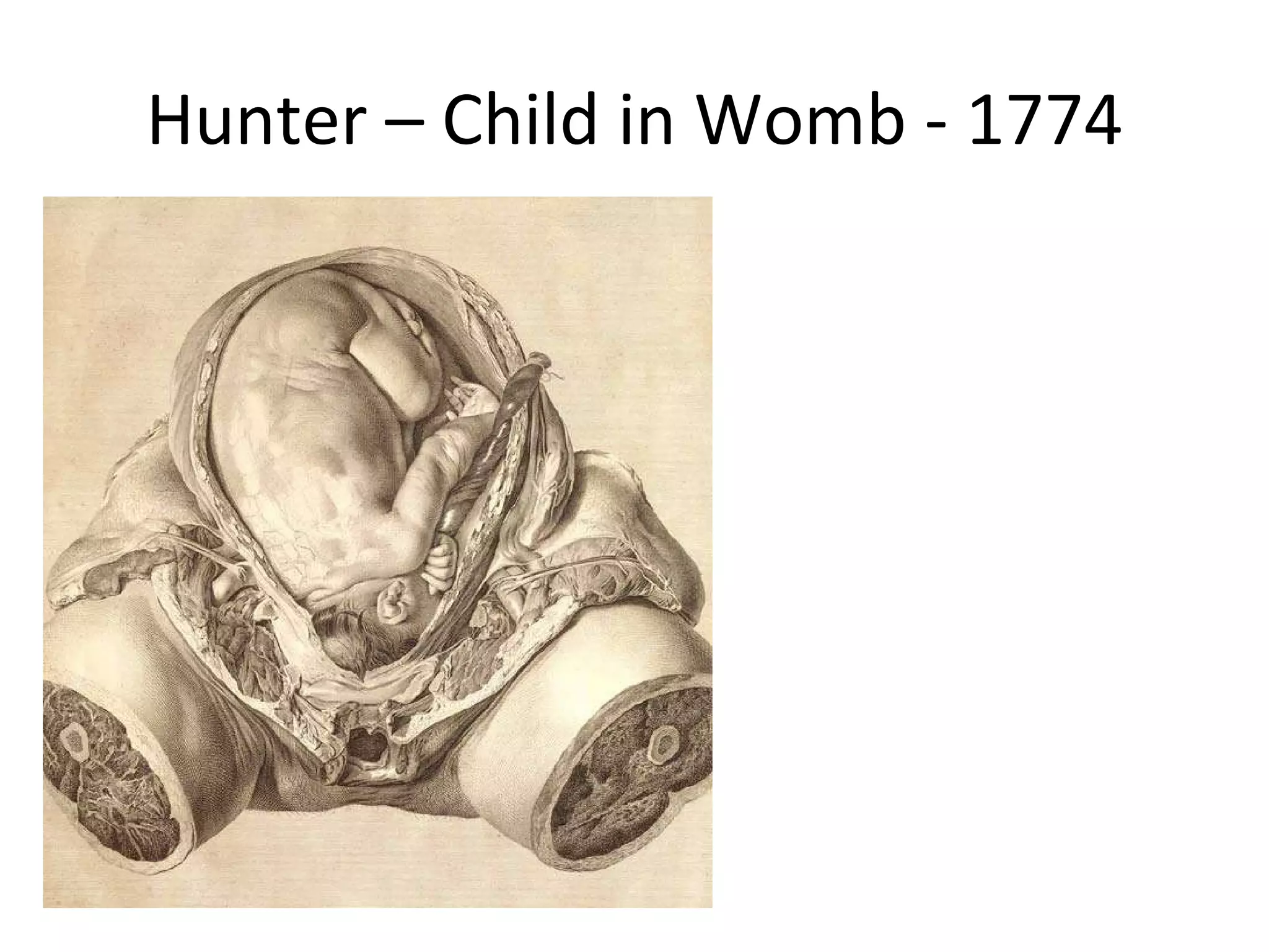 Hunter – Child in Womb - 1774 