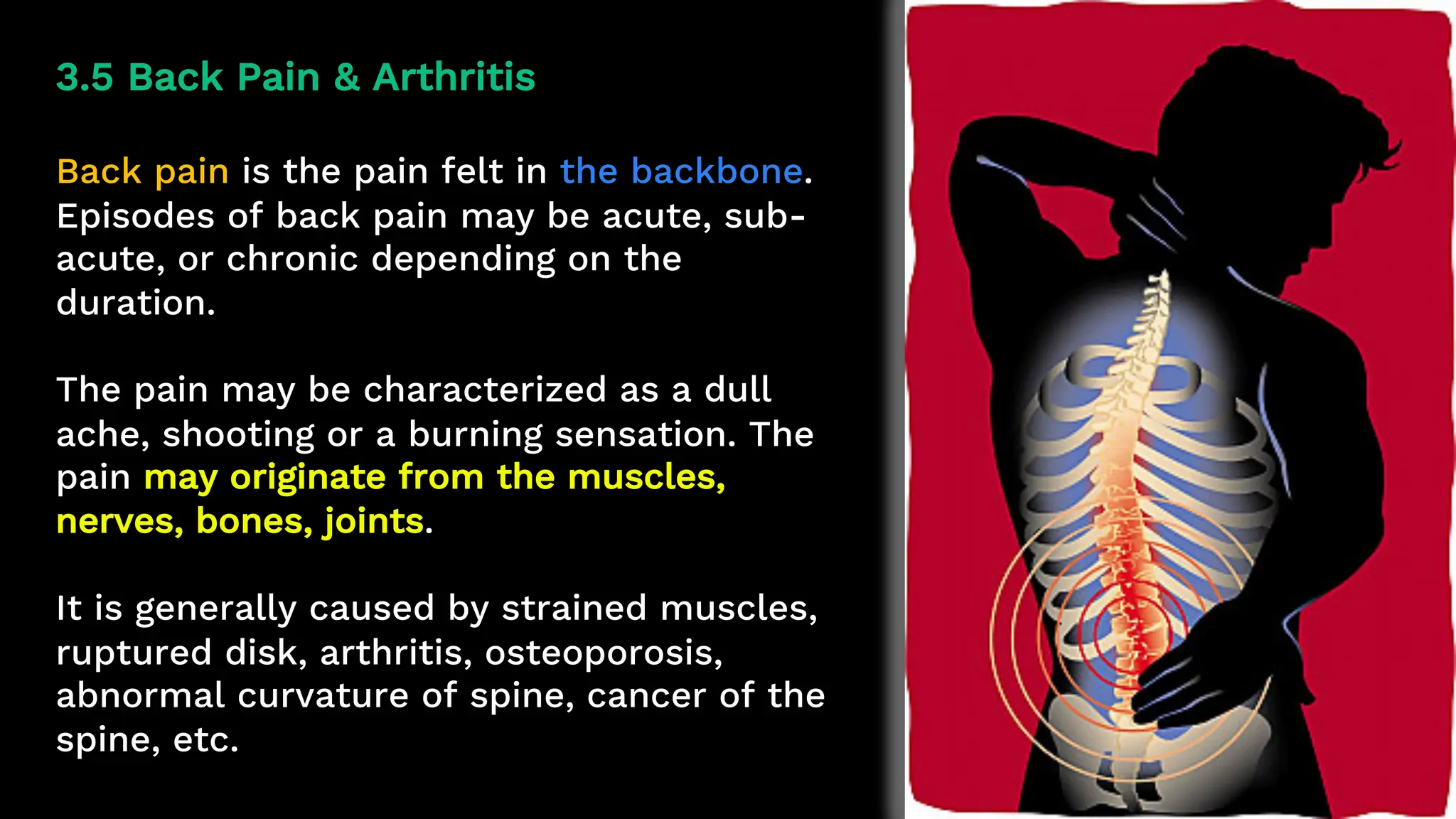 3.5 Back Pain & Arthritis
Back pain is the pain felt in the backbone.
Episodes of back pain may be acute, sub-
acute, or chronic depending on the
duration.
The pain may be characterized as a dull
ache, shooting or a burning sensation. The
pain may originate from the muscles,
nerves, bones, joints.
It is generally caused by strained muscles,
ruptured disk, arthritis, osteoporosis,
abnormal curvature of spine, cancer of the
spine, etc.
 
