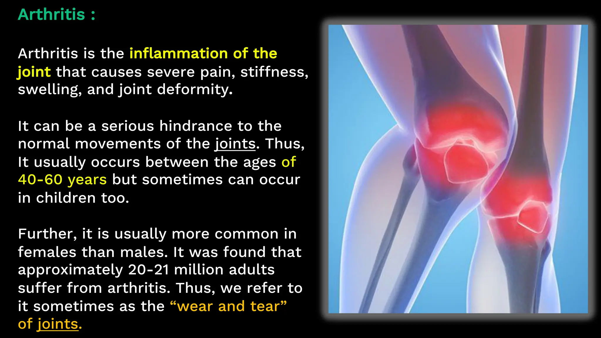 Arthritis :
Arthritis is the inflammation of the
joint that causes severe pain, stiffness,
swelling, and joint deformity.
It can be a serious hindrance to the
normal movements of the joints. Thus,
It usually occurs between the ages of
40-60 years but sometimes can occur
in children too.
Further, it is usually more common in
females than males. It was found that
approximately 20-21 million adults
suffer from arthritis. Thus, we refer to
it sometimes as the “wear and tear”
of joints.
 