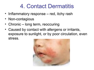 Ch 4 Skin Problems | PPT