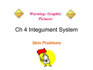 Skin Problems Ch 4 Integument System Warning: Graphic Pictures 