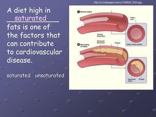 http://z.hubpages.com/u/105829_f520.jpgA diet high in____________fats is one of the factors that can contribute to cardiovasculardisease.saturatedsaturated   unsaturated