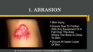 ch-7 class 12th physiology and injuries in sports.pptx