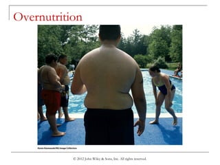 © 2012 John Wiley & Sons, Inc. All rights reserved.
Overnutrition
 