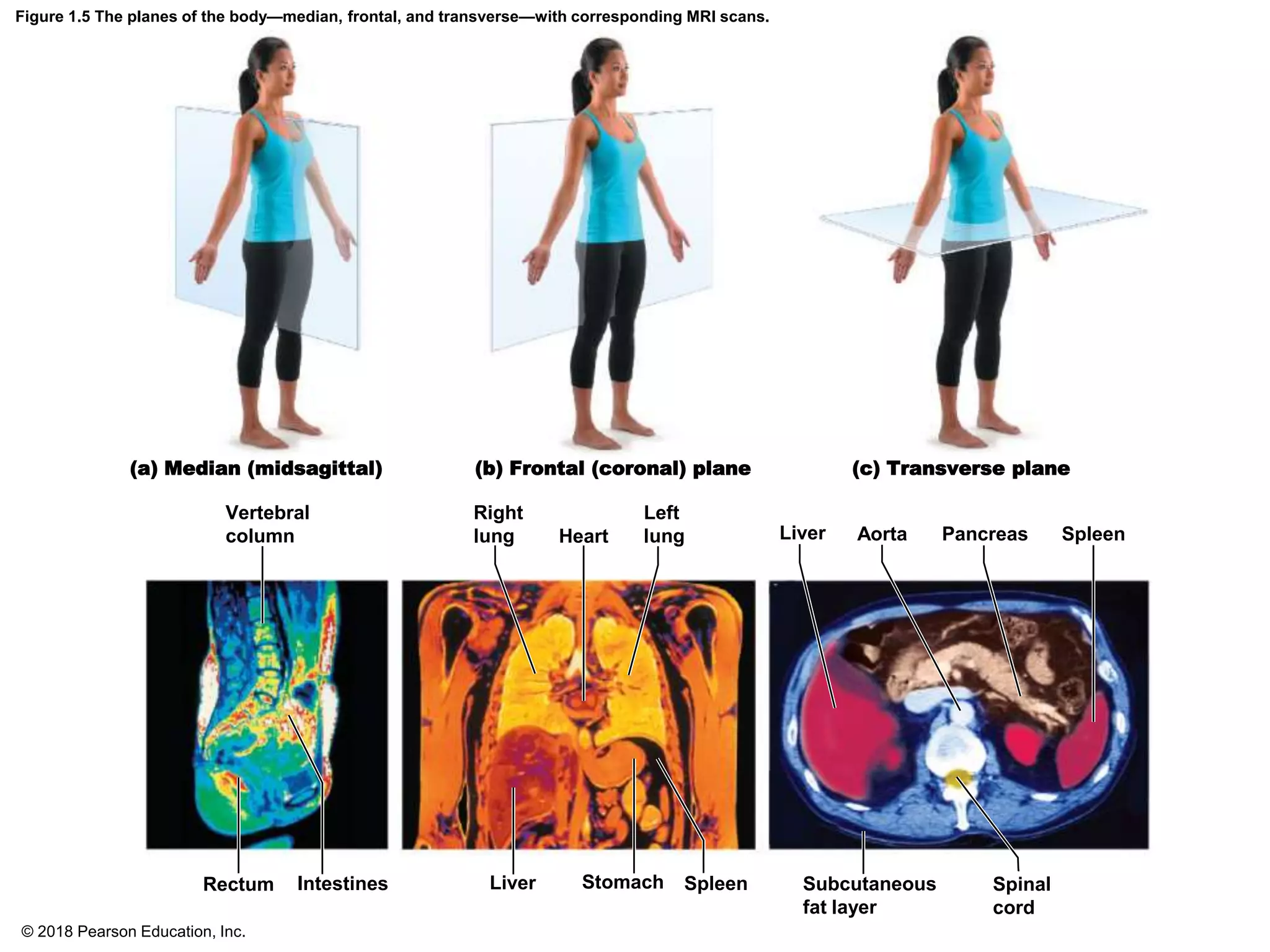 Figure 1.5 The planes of the body—median, frontal, and transverse—with corresponding MRI scans.
(a) Median (midsagittal) (b) Frontal (coronal) plane (c) Transverse plane
Vertebral
column
Right
lung Heart
Left
lung Liver Aorta Pancreas Spleen
Rectum Intestines Liver Stomach Spleen Subcutaneous
fat layer
Spinal
cord
© 2018 Pearson Education, Inc.
 
