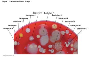Figure 1.16 Bacterial colonies on agar
Bacterium 1
Bacterium 2
Bacterium 3
Bacterium 4
Bacterium 5
Bacterium 6 Bacterium 7
Bacterium 8
Bacterium 9
Bacterium 10
Bacterium 11
Bacterium 12
 