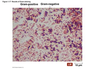 Figure 1.17 Results of Gram staining
Gram-positive Gram-negative
 